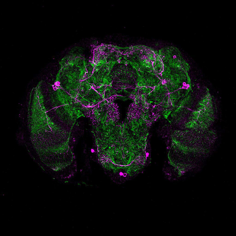 Pink stains show dopamine in the mosquitoâs brain. (Image: